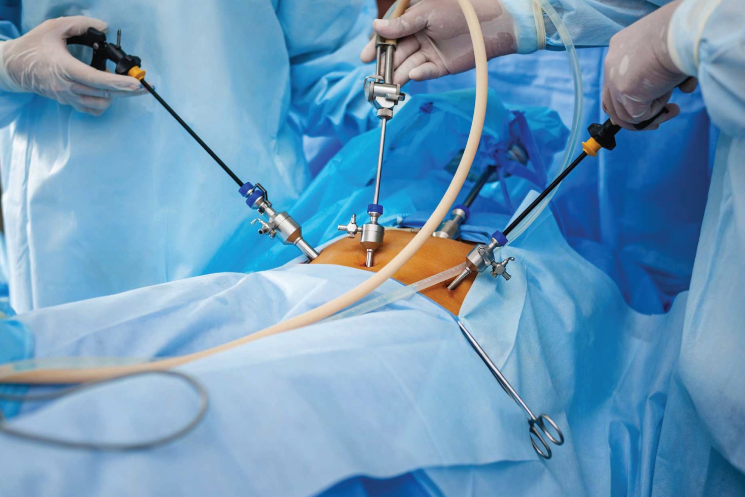Endoscopic & Laproscopic Surgery